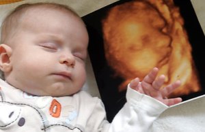 ultrasoud-and-baby ultrasoud-and-baby